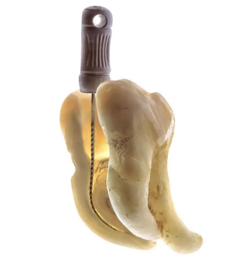 Endodoncia